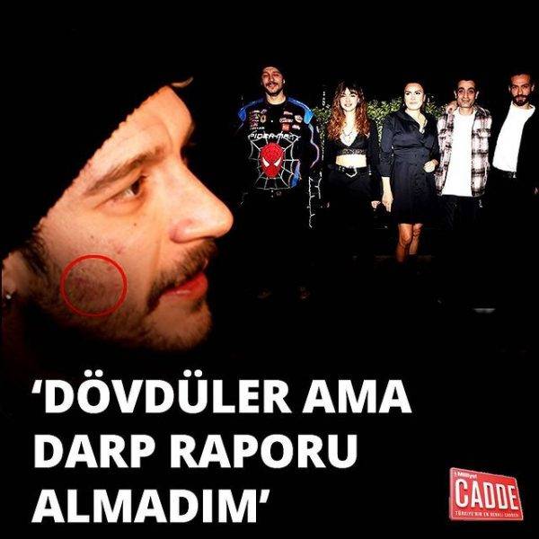 Ураз Кайгыралоглу